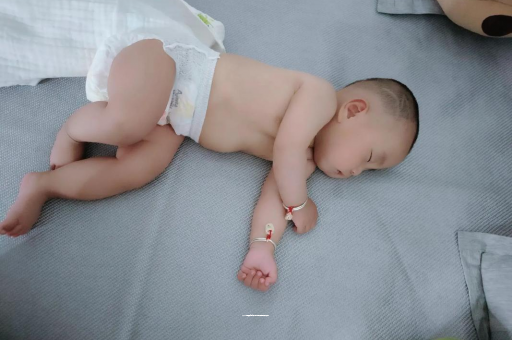 黔东六个月宝宝眼睛散光